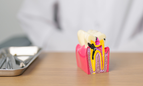 Periodontoloji